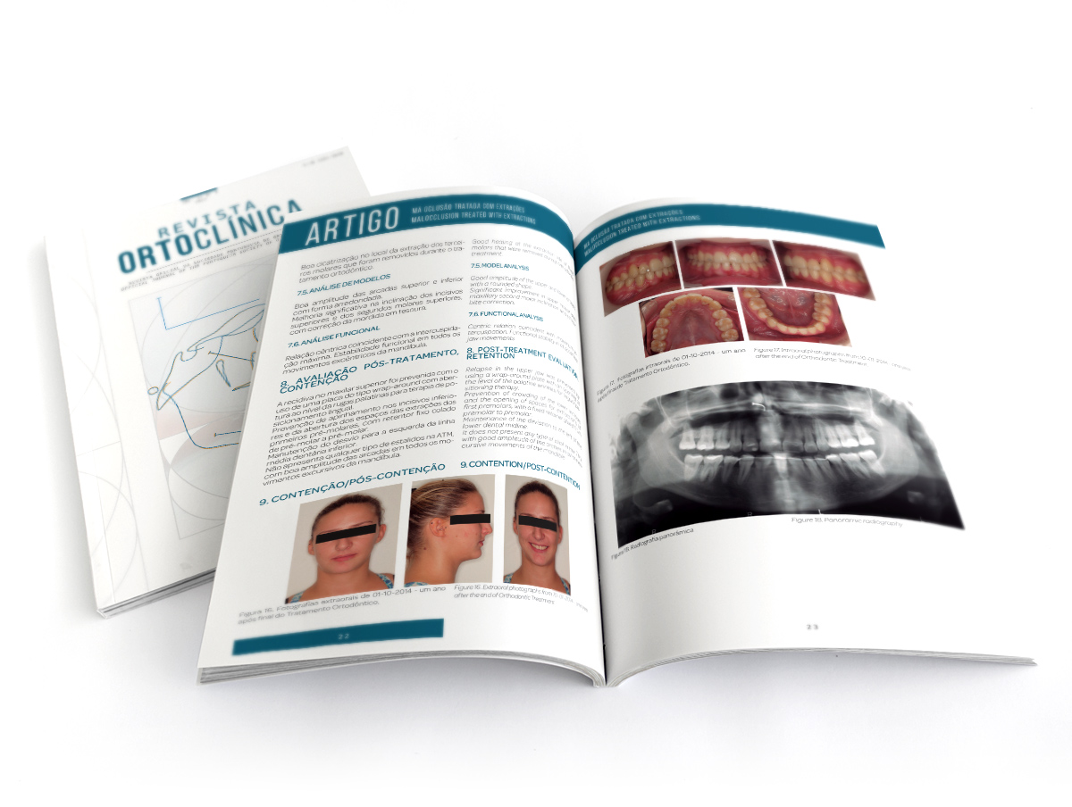 Revista Ortoclínica Sociedade Portuguesa de Ortodontia